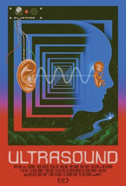 ULTRASOUND