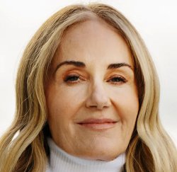 ELLEN GOLDSTEIN-VEIN